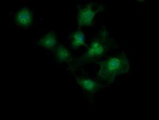 MAGEA4 Antibody in Immunocytochemistry (ICC/IF)