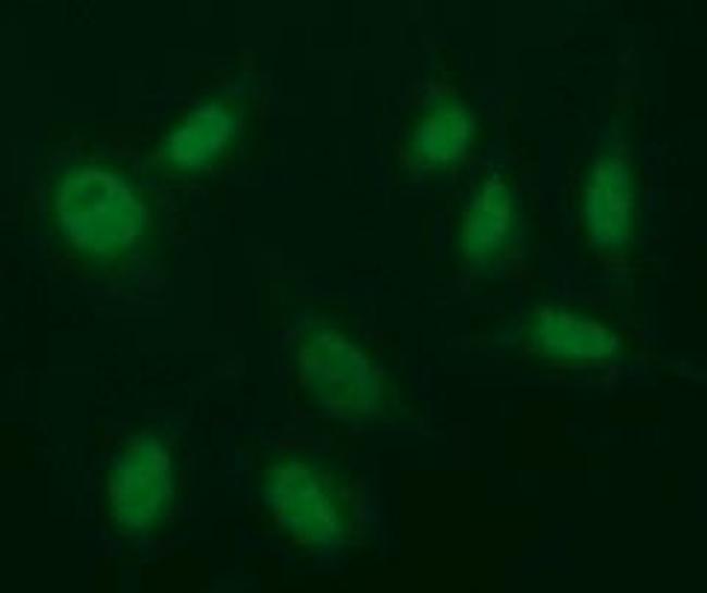 EGR2 Antibody in Immunocytochemistry (ICC/IF)