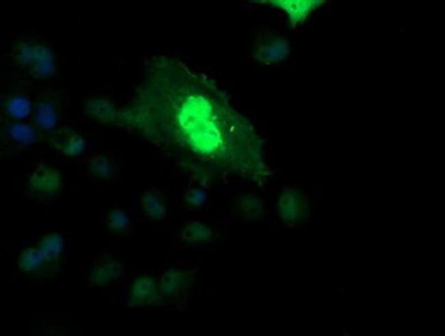 ETS2 Antibody in Immunocytochemistry (ICC/IF)