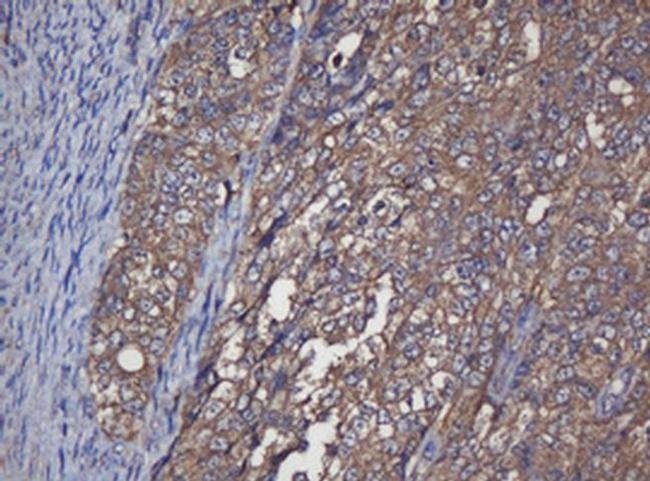 Alpha A Crystallin Antibody in Immunohistochemistry (Paraffin) (IHC (P))