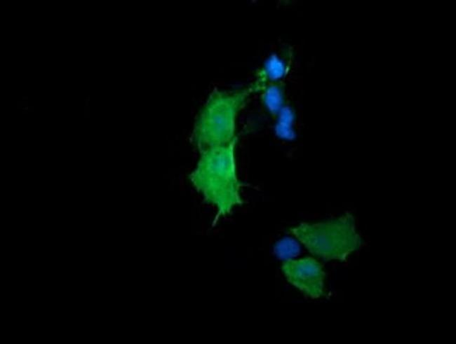 RhoJ Antibody in Immunocytochemistry (ICC/IF)