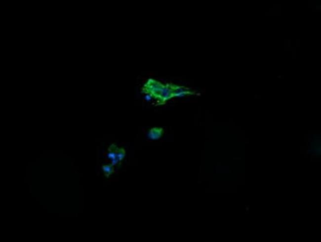 Alpha A Crystallin Antibody in Immunocytochemistry (ICC/IF)