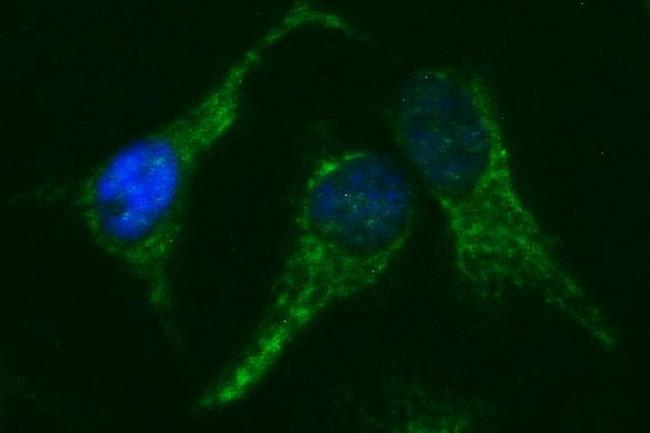 NR1 Antibody in Immunocytochemistry (ICC/IF)