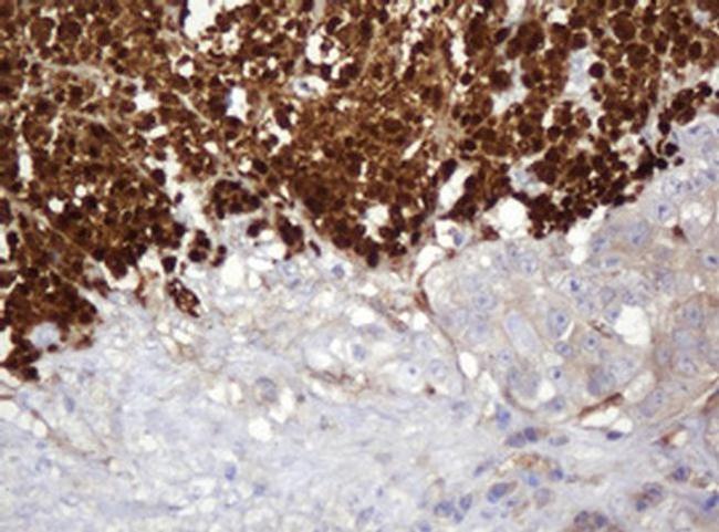 PARVB Antibody in Immunohistochemistry (Paraffin) (IHC (P))