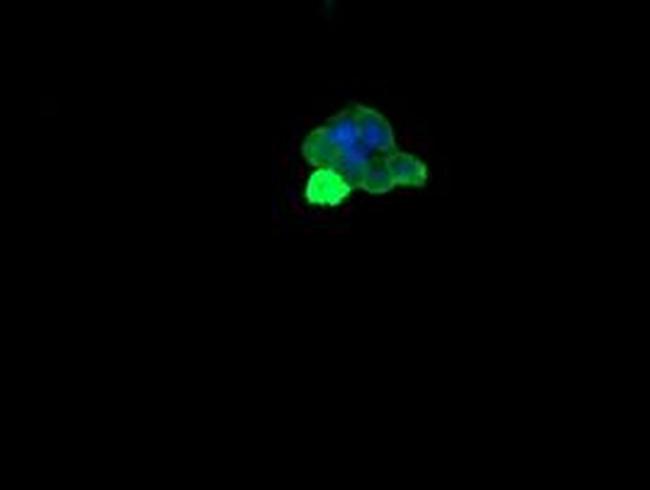 MDMX Antibody in Immunocytochemistry (ICC/IF)