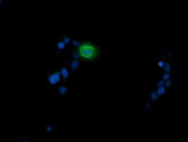 MDMX Antibody in Immunocytochemistry (ICC/IF)