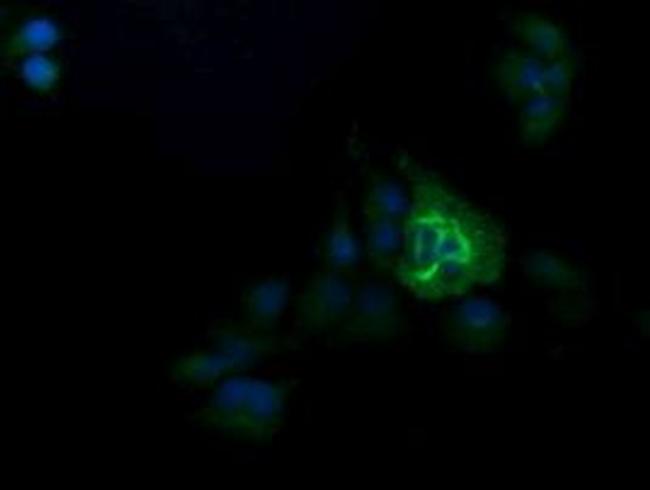 TRIM38 Antibody in Immunocytochemistry (ICC/IF)