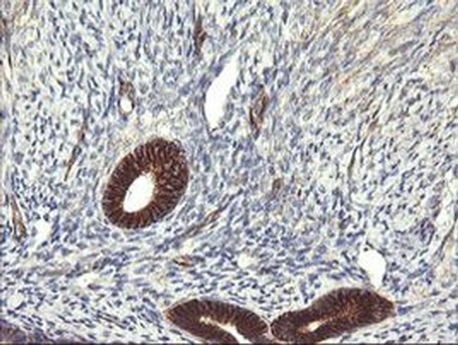 TRIM38 Antibody in Immunohistochemistry (Paraffin) (IHC (P))