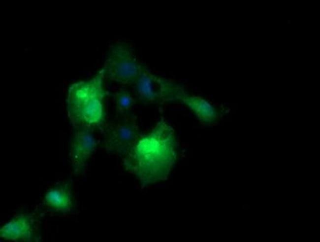 ERG Antibody in Immunocytochemistry (ICC/IF)