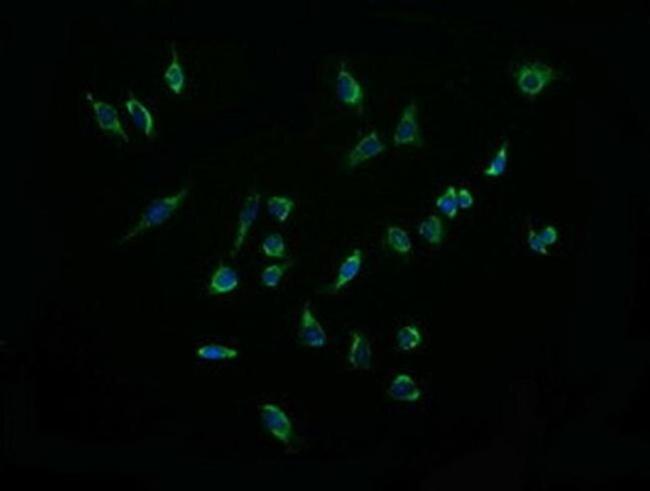 ACAA2 Antibody in Immunocytochemistry (ICC/IF)