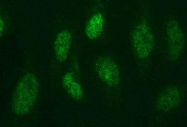 PMS2 Antibody in Immunocytochemistry (ICC/IF)