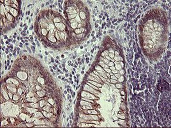 IFNGR2 Antibody in Immunohistochemistry (Paraffin) (IHC (P))