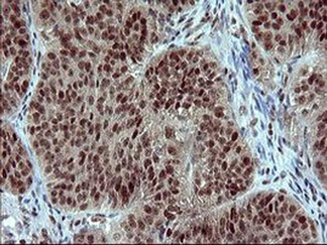 RAPGEF1 Antibody in Immunohistochemistry (Paraffin) (IHC (P))