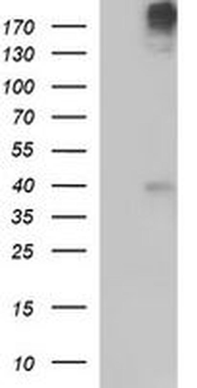 PLB1 Antibody in Western Blot (WB)