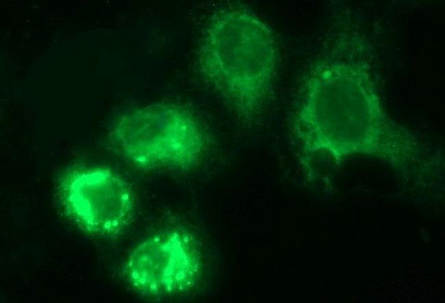 HERPUD1 Antibody in Immunocytochemistry (ICC/IF)