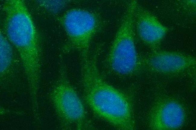 SR-BI Antibody in Immunocytochemistry (ICC/IF)