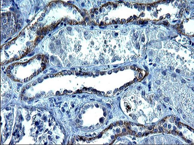 SCF Antibody in Immunohistochemistry (Paraffin) (IHC (P))