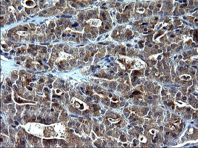 SCP2 Antibody in Immunohistochemistry (Paraffin) (IHC (P))