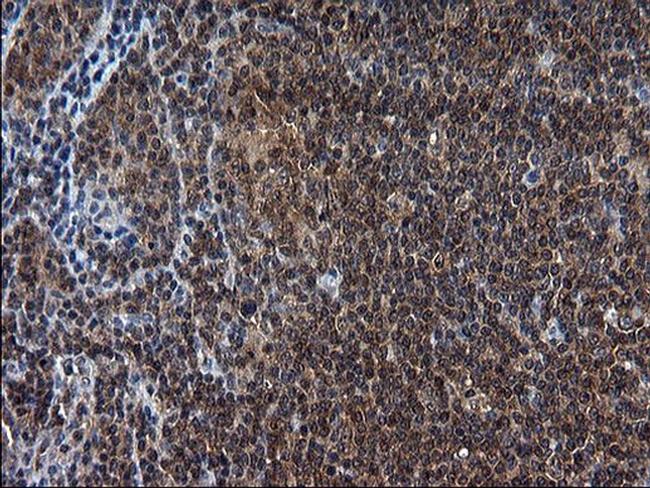 SCRN1 Antibody in Immunohistochemistry (Paraffin) (IHC (P))