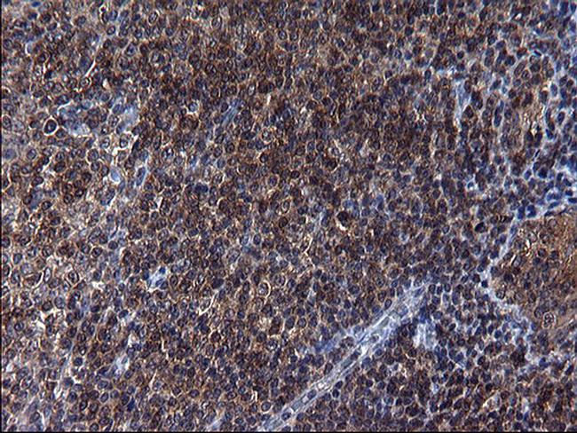 SCRN1 Antibody in Immunohistochemistry (Paraffin) (IHC (P))