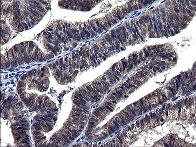 TXNDC5 Antibody in Immunohistochemistry (Paraffin) (IHC (P))