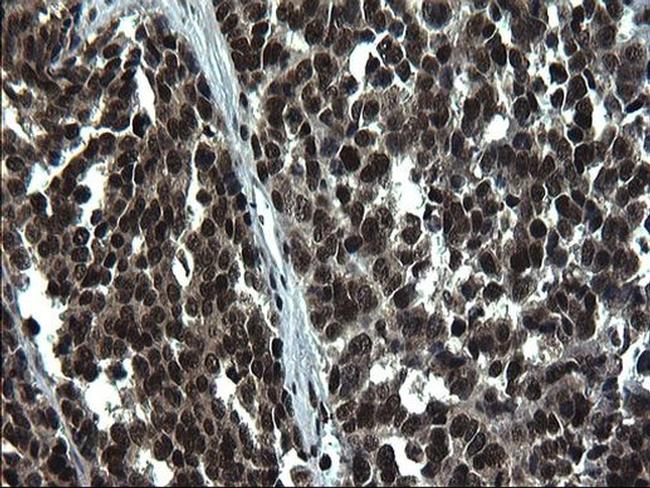 RPRD1B Antibody in Immunohistochemistry (Paraffin) (IHC (P))