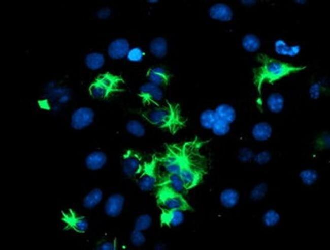 TRIM9 Antibody in Immunocytochemistry (ICC/IF)