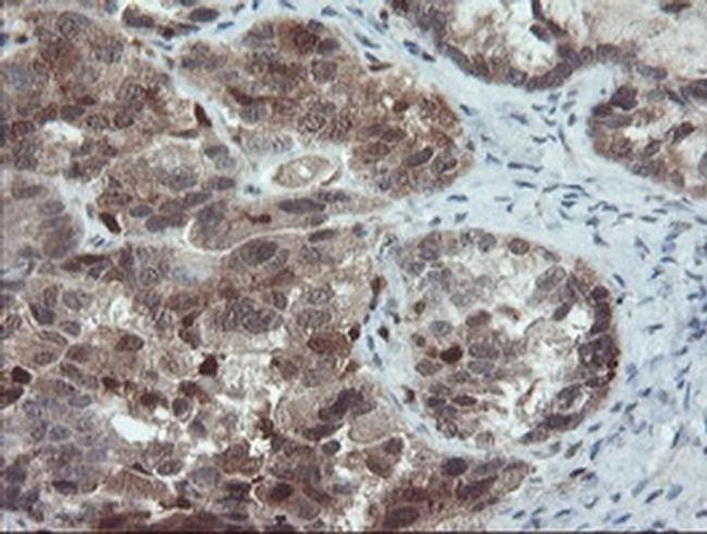 PYCARD Antibody in Immunohistochemistry (Paraffin) (IHC (P))