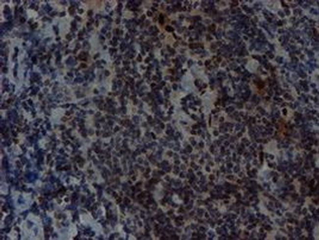 SLUG Antibody in Immunohistochemistry (Paraffin) (IHC (P))