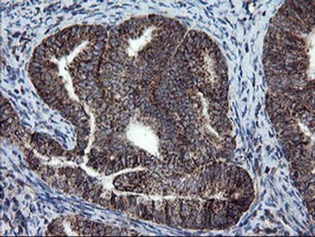 SnoN Antibody in Immunohistochemistry (Paraffin) (IHC (P))