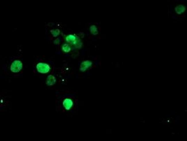 SLUG Antibody in Immunocytochemistry (ICC/IF)