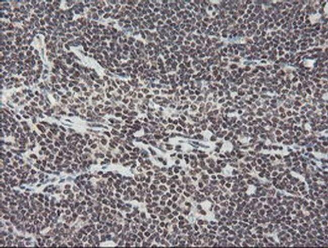 TPRKB Antibody in Immunohistochemistry (Paraffin) (IHC (P))