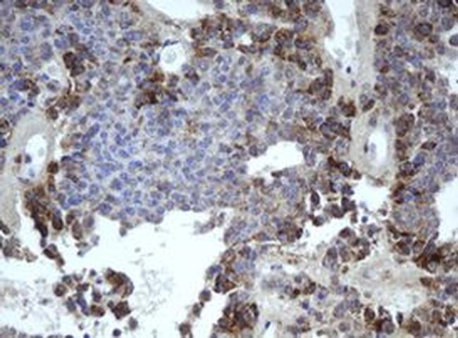 MIPEP Antibody in Immunohistochemistry (Paraffin) (IHC (P))