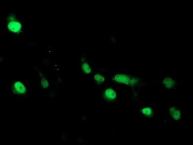 ARL2BP Antibody in Immunocytochemistry (ICC/IF)