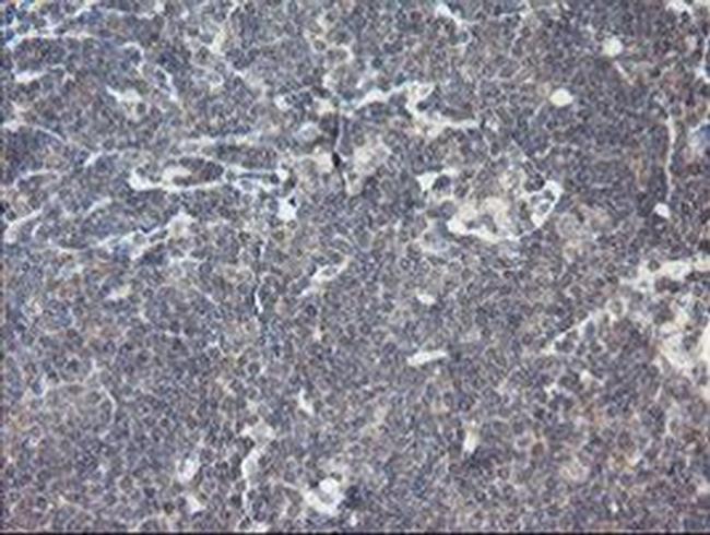 RIP1 Antibody in Immunohistochemistry (Paraffin) (IHC (P))