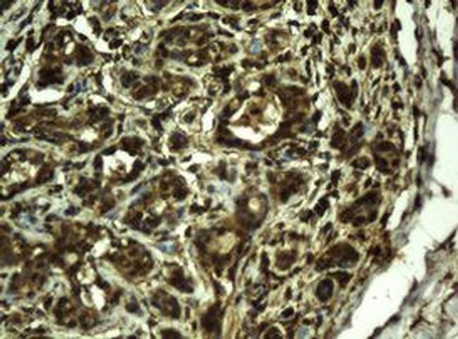 RIP1 Antibody in Immunohistochemistry (Paraffin) (IHC (P))