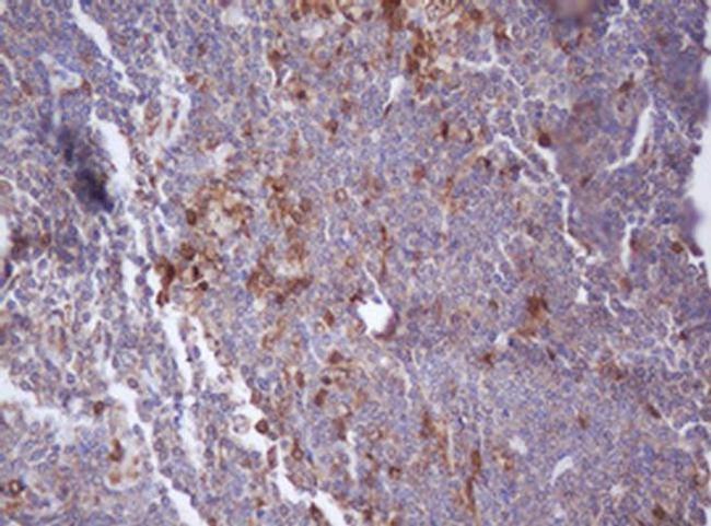 IDH1 Antibody in Immunohistochemistry (Paraffin) (IHC (P))