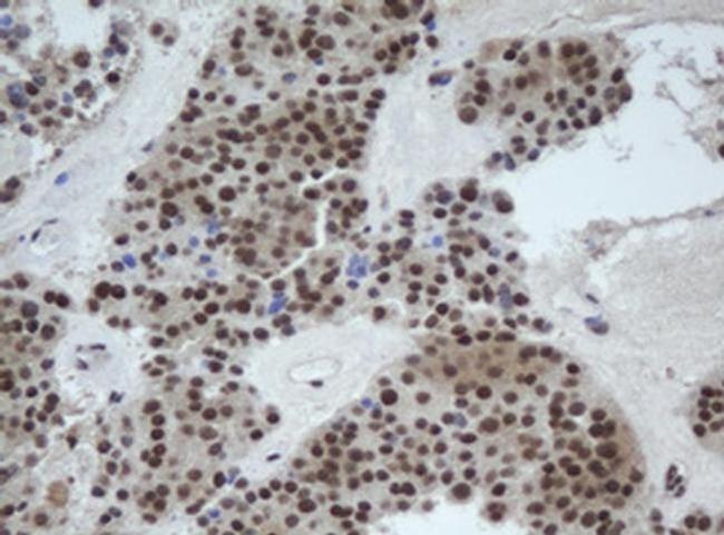 Cullin 4B Antibody in Immunohistochemistry (Paraffin) (IHC (P))