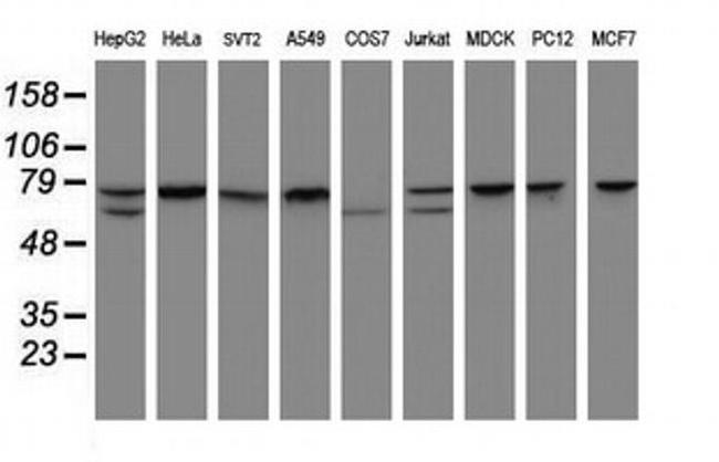 CCDC93 Antibody in Western Blot (WB)