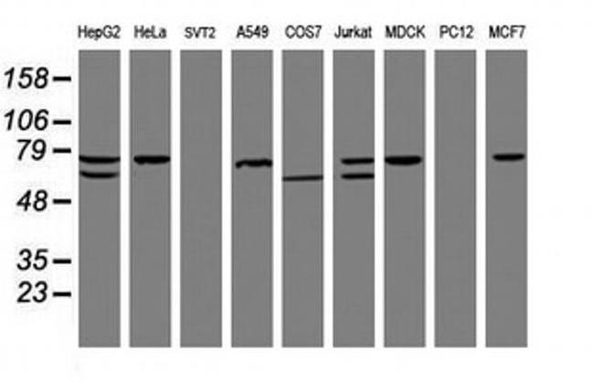 CCDC93 Antibody in Western Blot (WB)