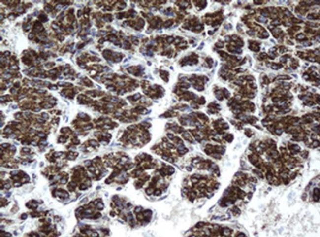 HSD17B8 Antibody in Immunohistochemistry (Paraffin) (IHC (P))