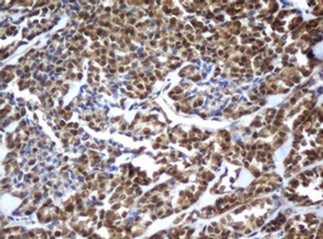 ZFAND5 Antibody in Immunohistochemistry (Paraffin) (IHC (P))