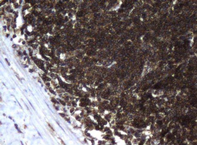 CCDC93 Antibody in Immunohistochemistry (Paraffin) (IHC (P))