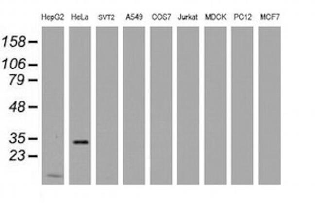 MMADHC Antibody in Western Blot (WB)