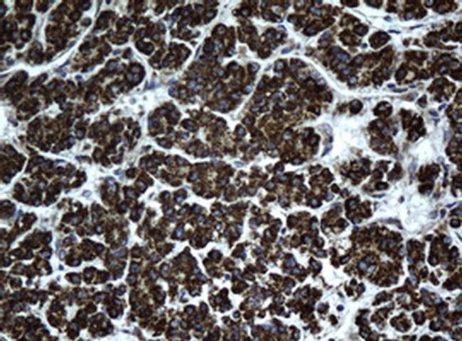 HSD17B8 Antibody in Immunohistochemistry (Paraffin) (IHC (P))