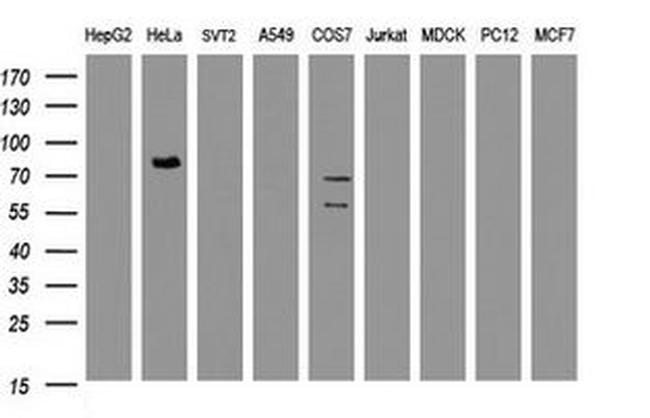 HBS1L Antibody in Western Blot (WB)