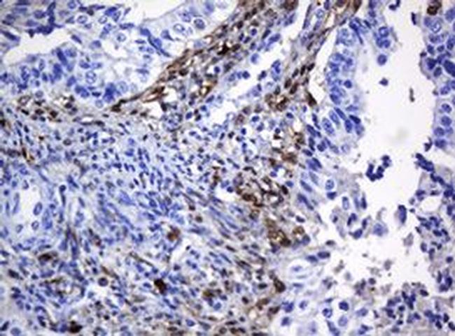 HOXD10 Antibody in Immunohistochemistry (Paraffin) (IHC (P))