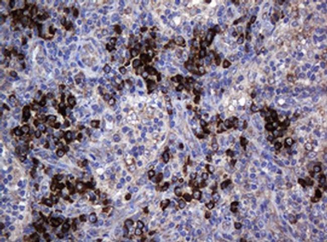 MAGEA3 Antibody in Immunohistochemistry (Paraffin) (IHC (P))