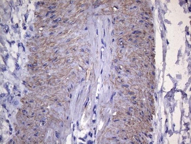 VEGFC Antibody in Immunohistochemistry (Paraffin) (IHC (P))