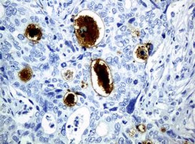 WFDC2 Antibody in Immunohistochemistry (Paraffin) (IHC (P))